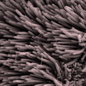 Cilia, tiny hairs protruding into the ventricles of the brain, wave in synchrony to pump around CSF. This function is impaired in the HD brain, though it's not yet clear if this is related to the "trash disposal" problems observed in HD brains.